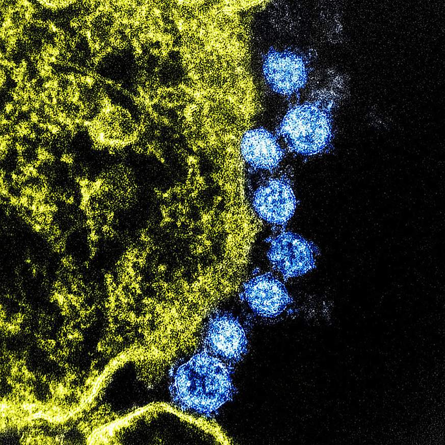 Image of coronavirus from National Institutes of Health